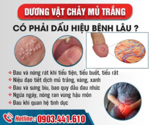 Dương vật chảy mủ trắng là bệnh gì? Địa chỉ khám dương vật chảy mủ ở Phú Thọ Hiệu Quả
